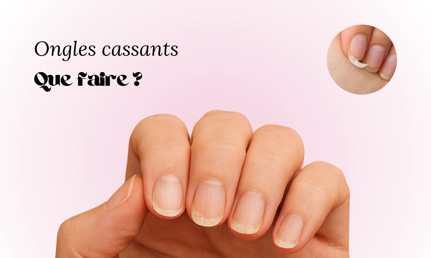 Ongles cassants : que faire ?