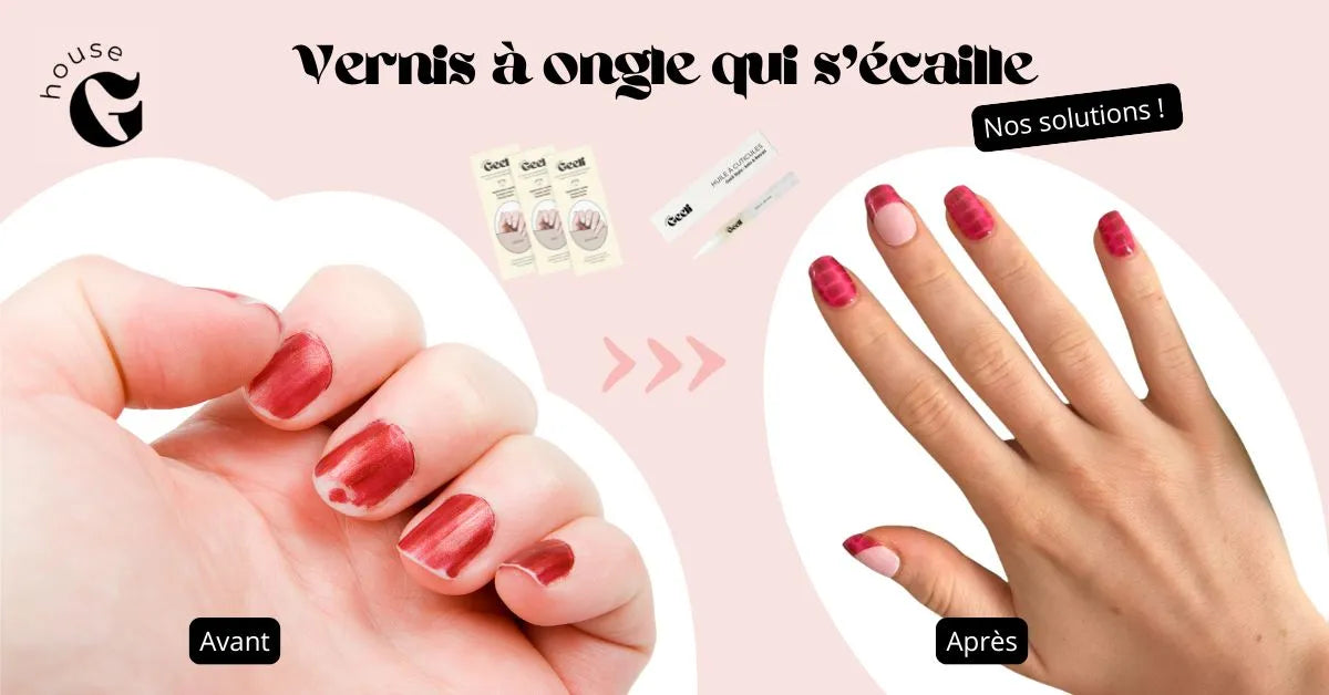 Vernis qui s’écaille : tout ce qui gâche votre manucure et comment y remédier