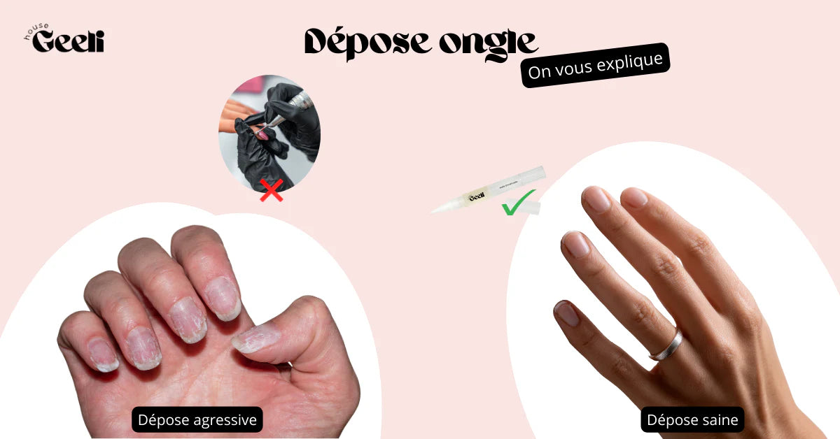 dépose ongle geeli house
